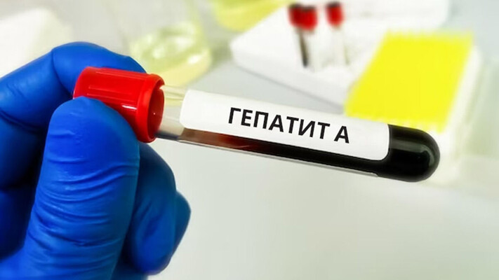 В Киеве зафиксировали вспышку гепатита А