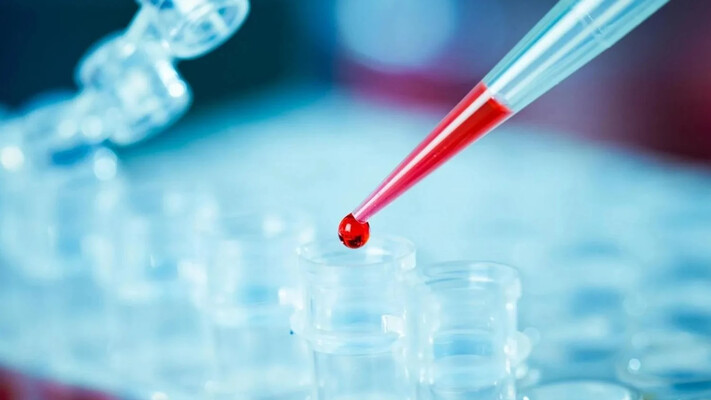 Ученые обнаружили антитело, блокирующее почти все варианты ВИЧ-инфекции