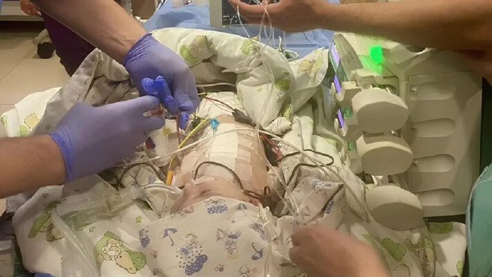 После уникальной операции: одесские врачи открыли новую страницу в детской кардиохирургии